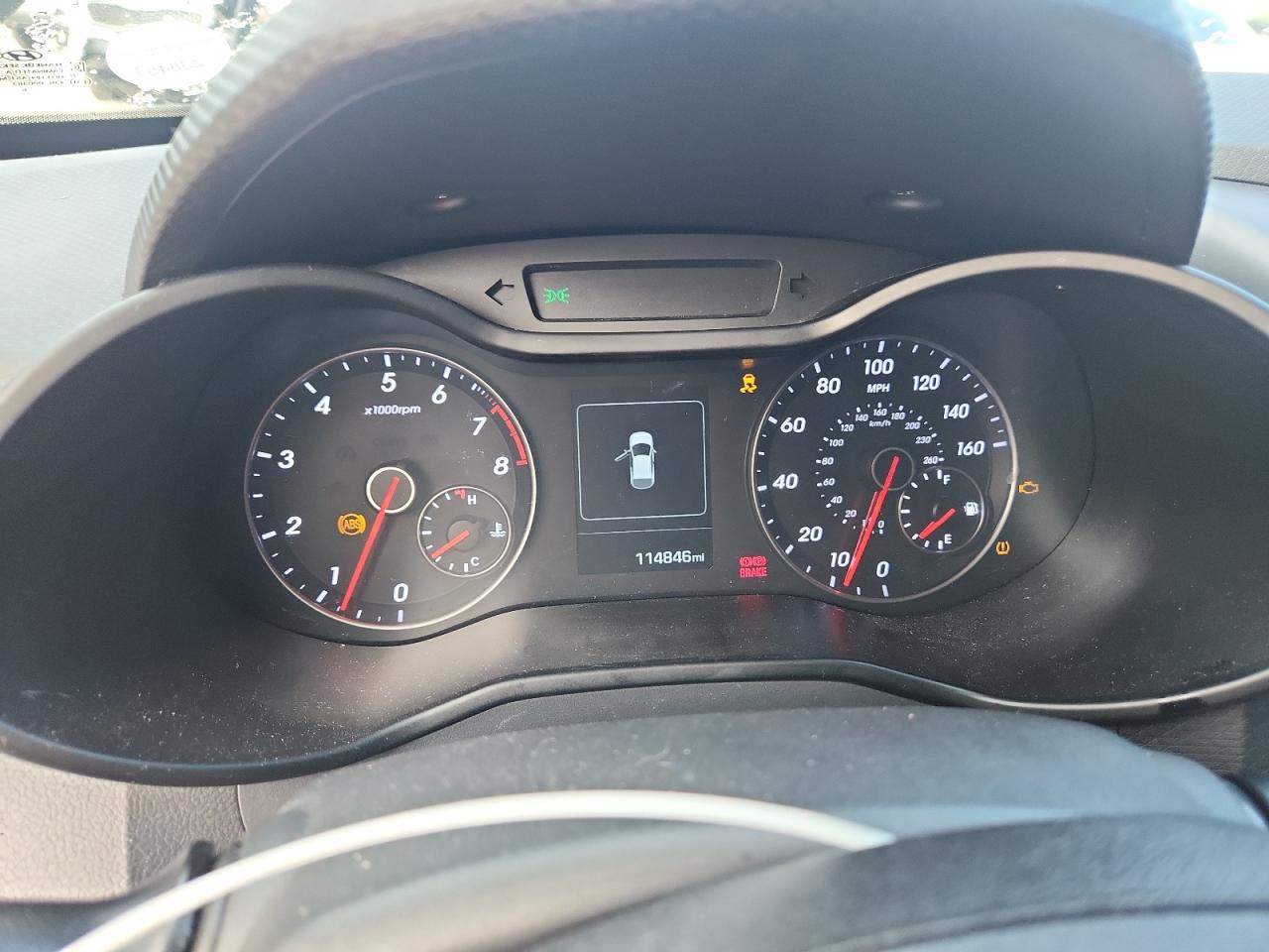 KMHTC6AE6GU303736 · 2016 HYUNDAI VELOSTER · 9/12