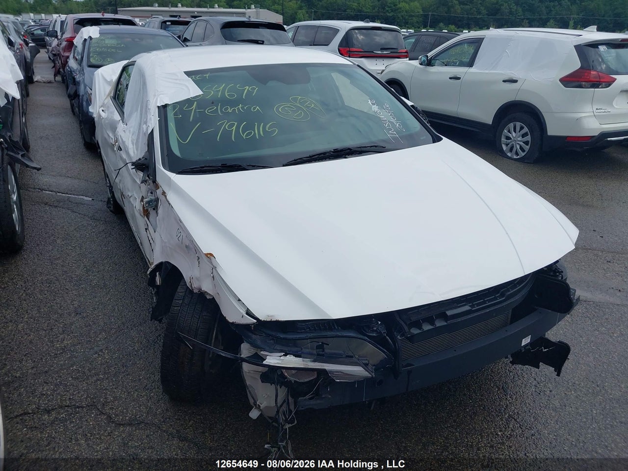 KMHLM4DG3RU796115 · 2024 HYUNDAI ELANTRA ESSENTIAL