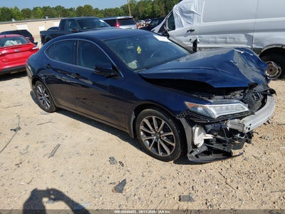 19UUB2F59HA****** · 2017 ACURA TLX TECHNOLOGY PACKAGE