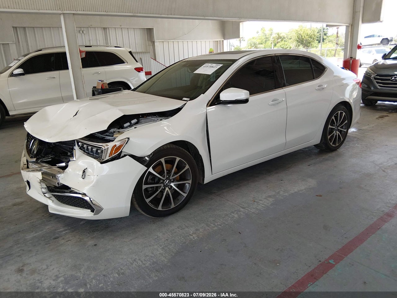 2020 ACURA TLX STANDARD · 2/11
