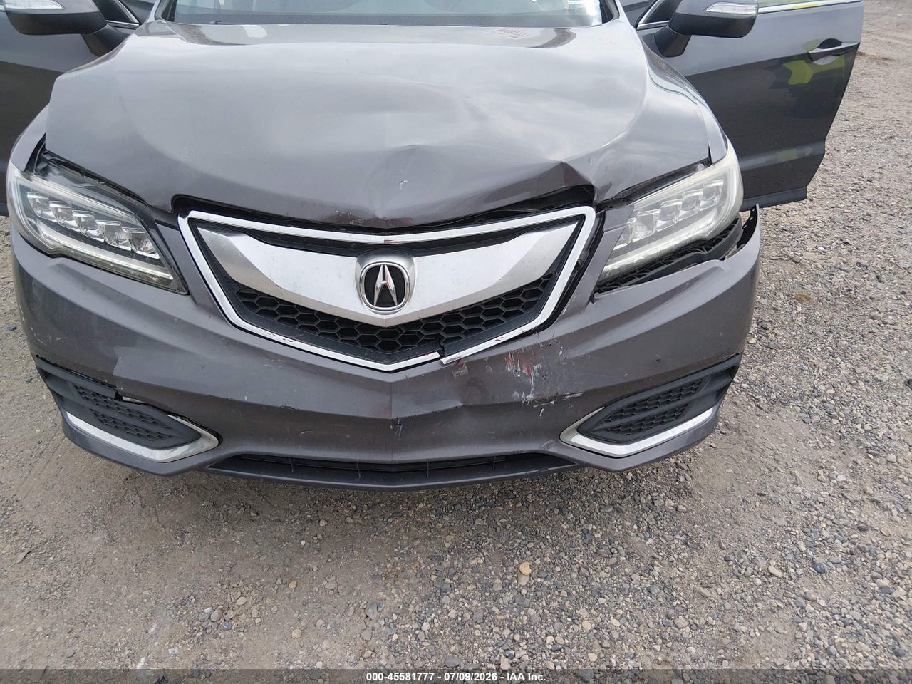 2018 ACURA RDX ACURAWATCH PLUS PACKAGE · 6/11
