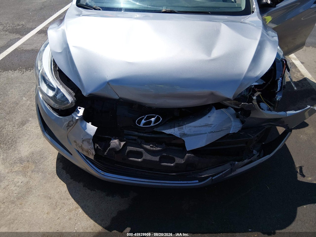 2016 HYUNDAI ELANTRA SE · 6/11