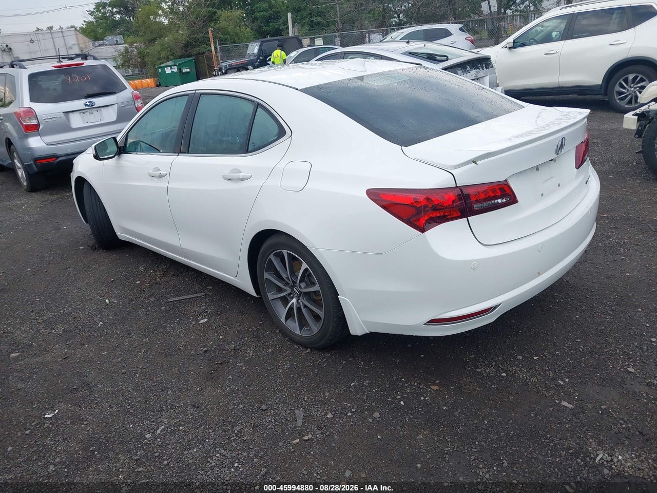 2015 ACURA TLX V6 ADVANCE · 3/11